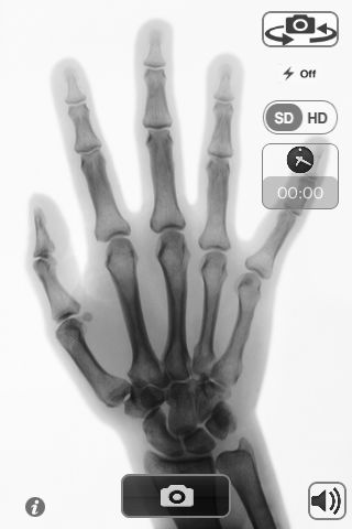 Download X-Ray Camera - Silent Free App on your Windows XP/7/8/10 and MAC PC